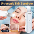 Blackhead remover kit