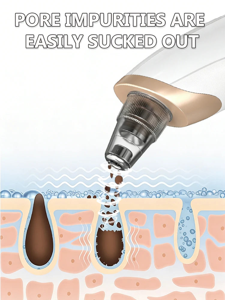 Pore vacuum detail