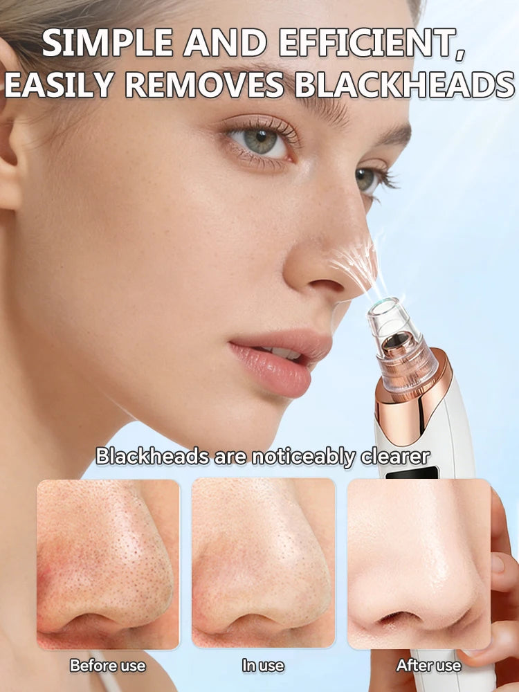 Pore vacuum in use