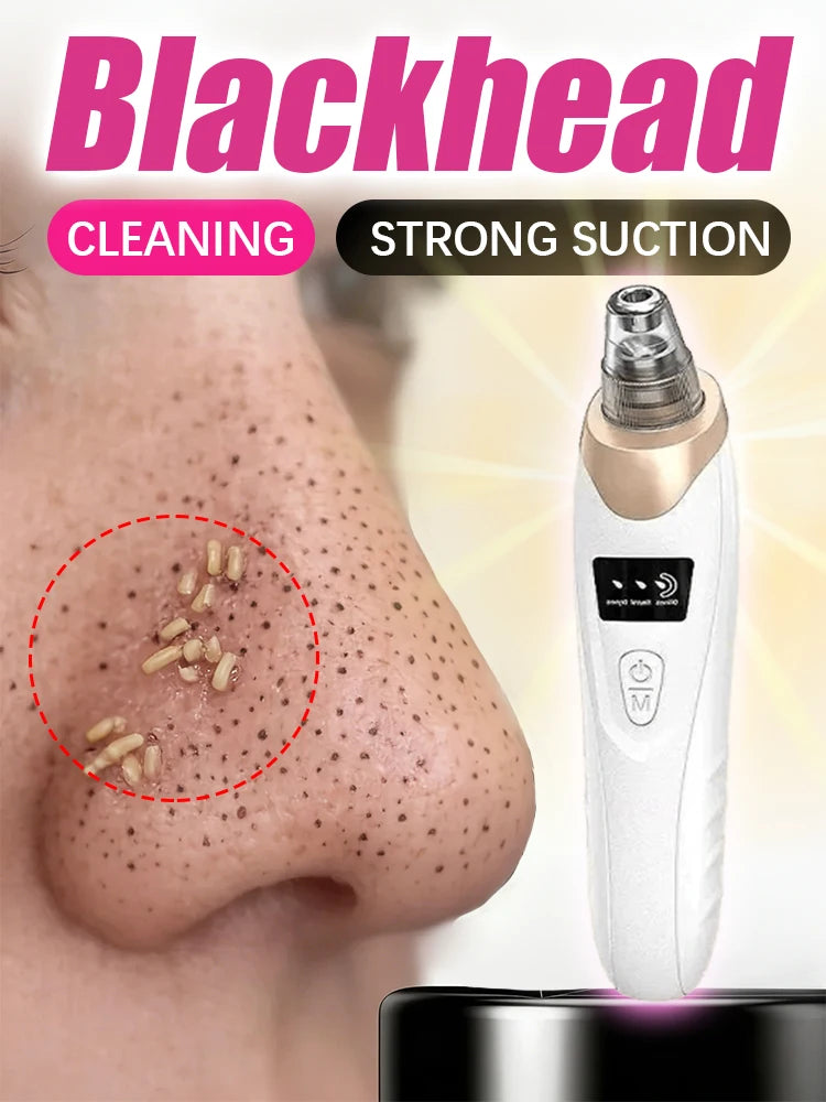 Blackhead pore vacuum