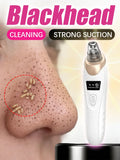 Blackhead pore vacuum
