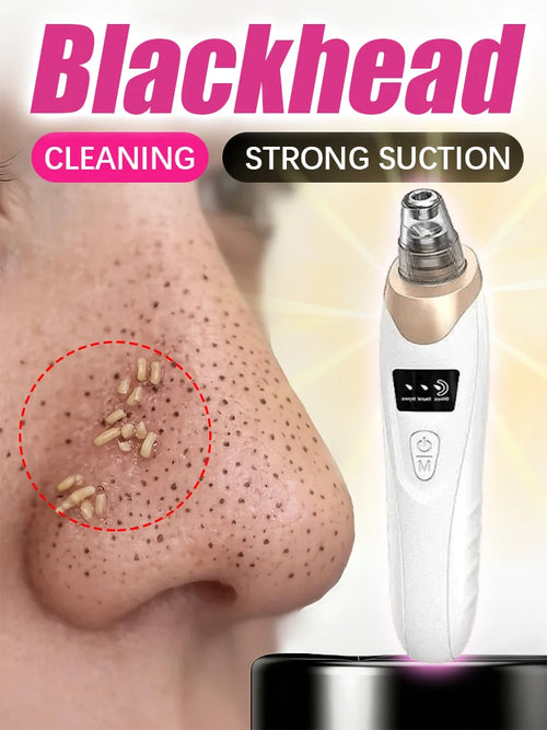 Blackhead pore vacuum